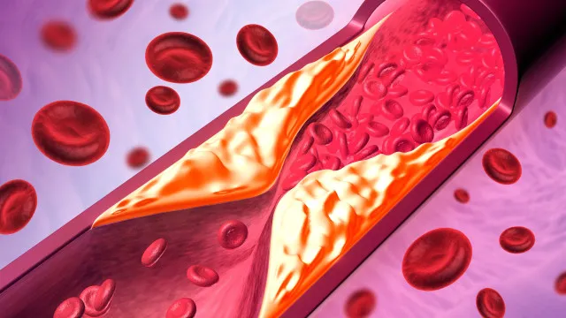 
                    Hábito no café da manhã pode elevar risco de doenças cardíacas; entenda
                