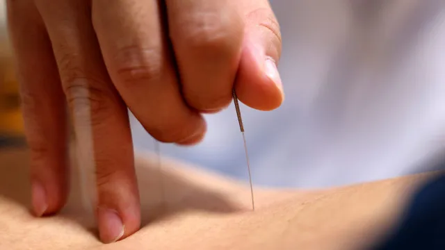 
                    6 principais benefícios da Acupuntura, segundo especialistas
                