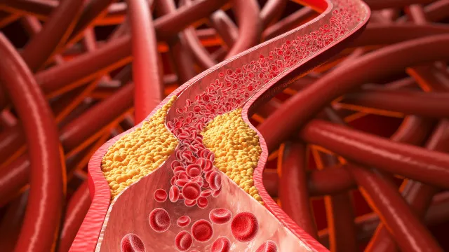 
                    Alimento comum pode ajudar a derrubar o colesterol “ruim”
                