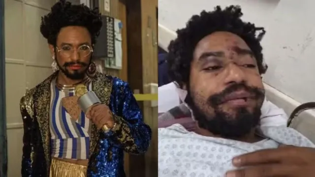 
                    Polícia de SP investiga grave ataque homofóbico ao ator Diego Summer
                