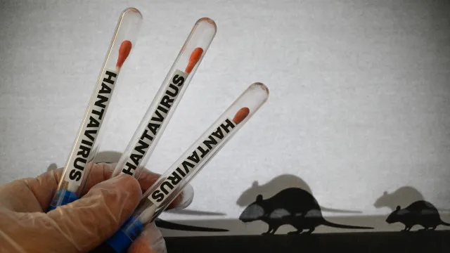 
                    Hantavírus: Como será feito desembarque de passageiros nas ilhas Canárias
                