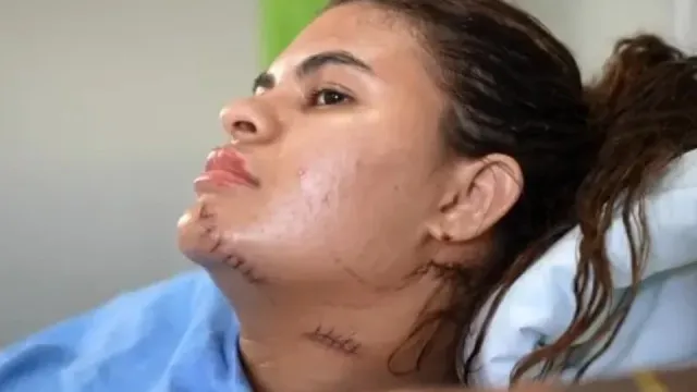 
                    'Me fiz de morta', diz estudante que teve as mãos amputadas em ataque com foice no Ceará
                