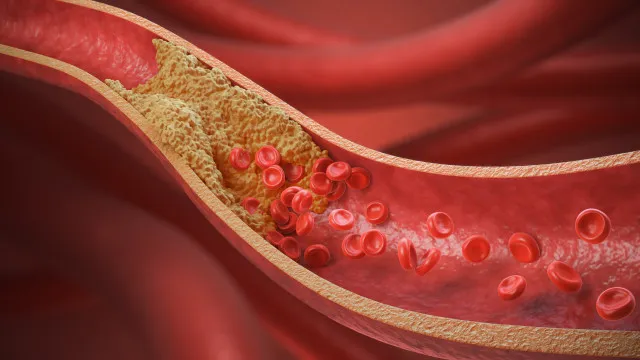 
                    10 alimentos que cardiologistas indicam para baixar o colesterol
                
