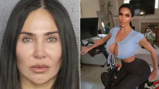 
                    Brasileira é condenada nos EUA por morte de sósia de Kim Kardashian após procedimento estético
                