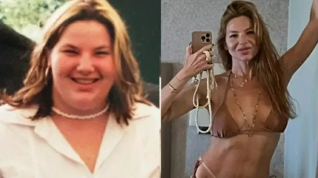 
                    Irreconhecível: Repórter da Globo perde 70kg e 8 dentes após bariátrica
                