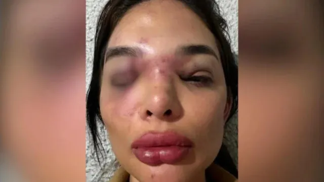 
                    Empresário é preso por suspeita de agredir mulher com taco de beisebol em SP
                