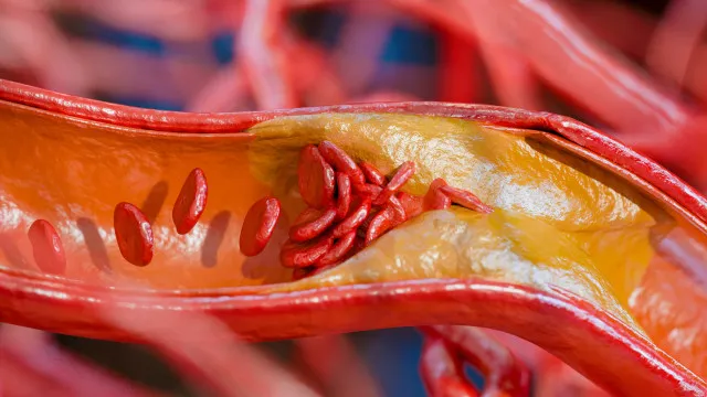 
                    5 alimentos ricos em proteína que também têm muita gordura; veja quais
                