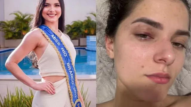 Empresário é condenado por agredir ex-Miss Universo após crise de ciúmes