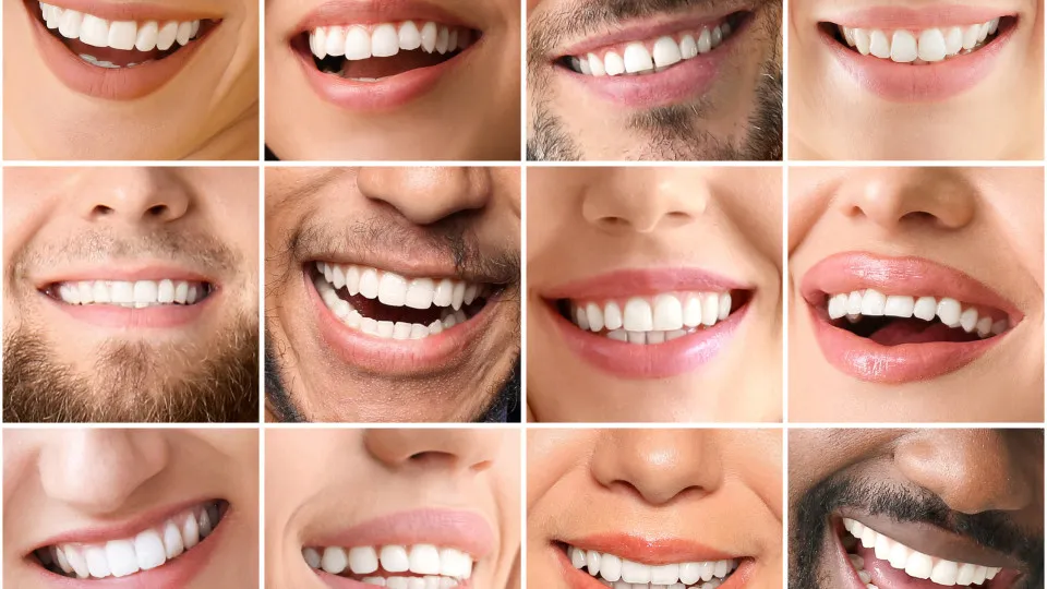 O formato da sua boca pode dizer muito sobre a sua personalidade - Not&iacute;cias  ao Minuto Brasil