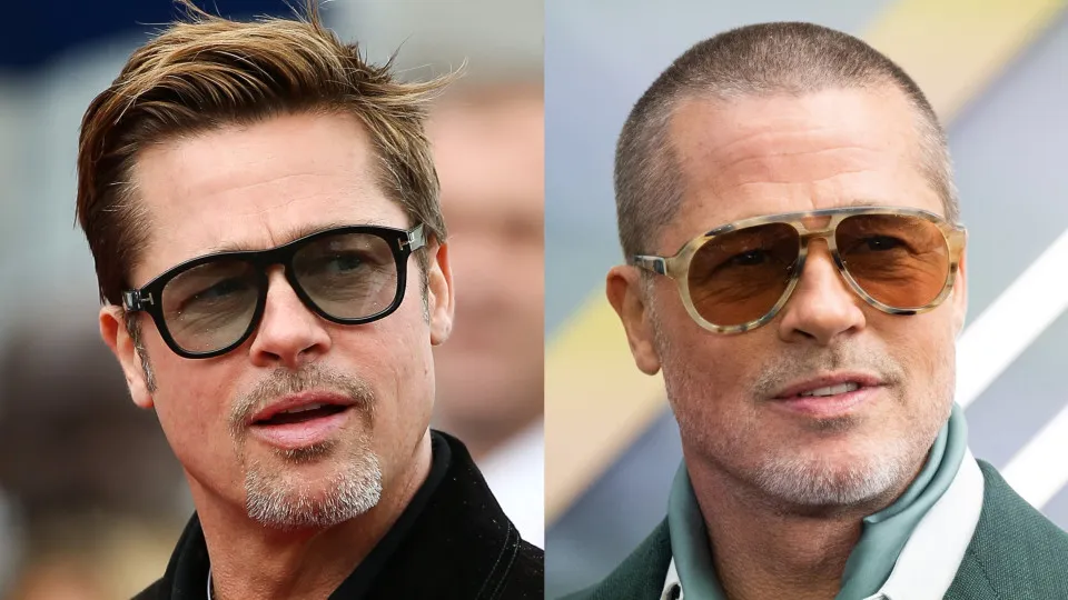 Antes e depois: Famosos em 2016 e em 2026