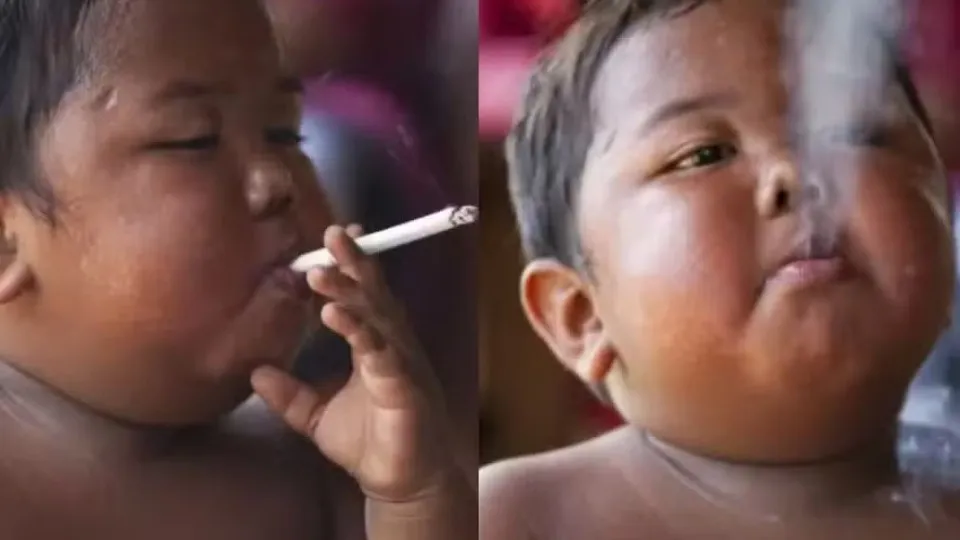 Lembra dele? Veja como ficou o menino que fumava 40 cigarros por dia